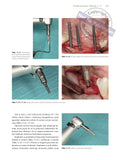 Implantoprotetika koncept usmjeren na pacijenta