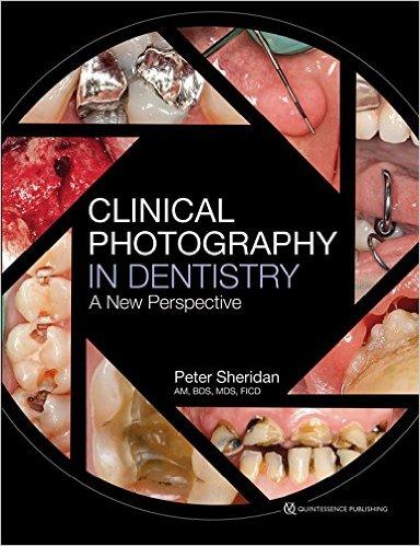 Clinical Photography in Dentistry