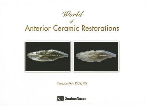 World of Anterior Ceramic Restorations