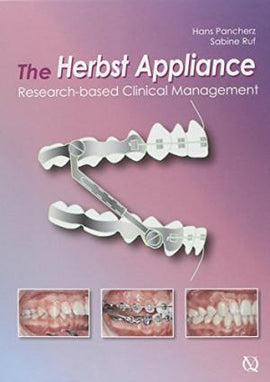 The Herbst Appliance