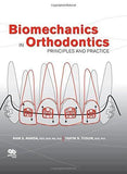 Biomechanics in Orthodontics