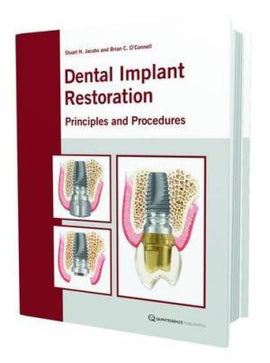 Dental Implant Restoration