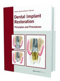 Dental Implant Restoration