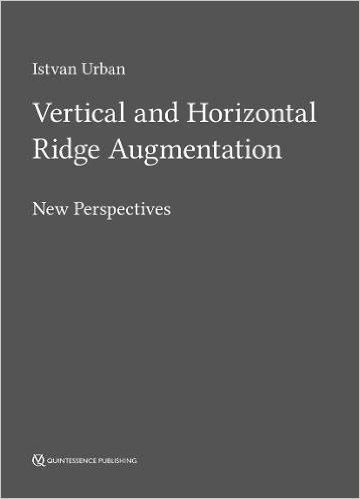 Vertical and Horizontal Ridge Augmentation