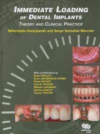 Immediate Loading of Dental Implants