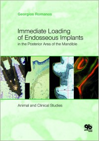 Immediate Loading of Endosseous Implants in the Posterior Area of the Mandible
