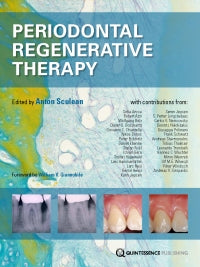 Periodontal Regenerative Therapy