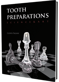 Tooth Preparations
