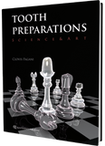 Tooth Preparations
