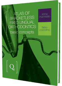 Atlas of Bracketless Fixed Lingual Orthodontics