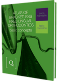 Atlas of Bracketless Fixed Lingual Orthodontics
