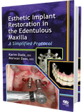 Esthetic Implant Restoration in the Edentulous Maxilla