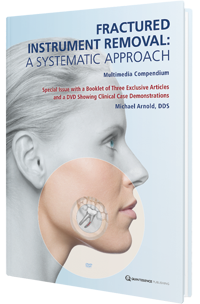 Fractured Instrument Removal A Systematic Approach