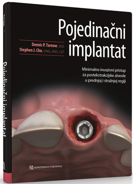 Pojedinačni implantat