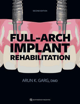 Full-Arch Implant Rehabilitation, 2nd Edition