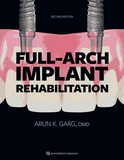 Full-Arch Implant Rehabilitation, 2nd Edition