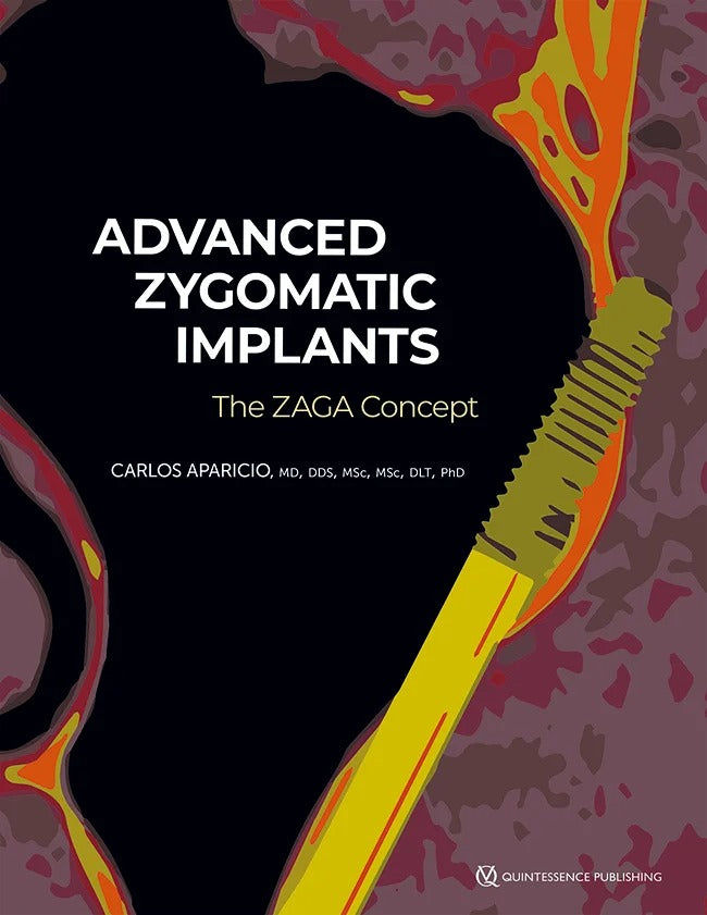 Advanced Zygomatic Implants