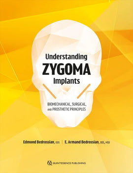 Understanding Zygoma Implants