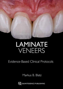 Laminate Veneers
