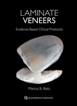 Laminate Veneers