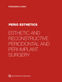 Perio Esthetics