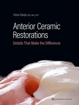 Anterior Ceramic Restorations