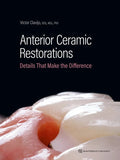 Anterior Ceramic Restorations