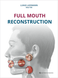 Full-Mouth Reconstruction