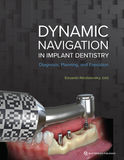 Dynamic Navigation in Implant Dentistry