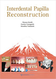 Interdental Papilla Reconstruction