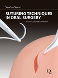 Suturing Techniques in Oral Surgery