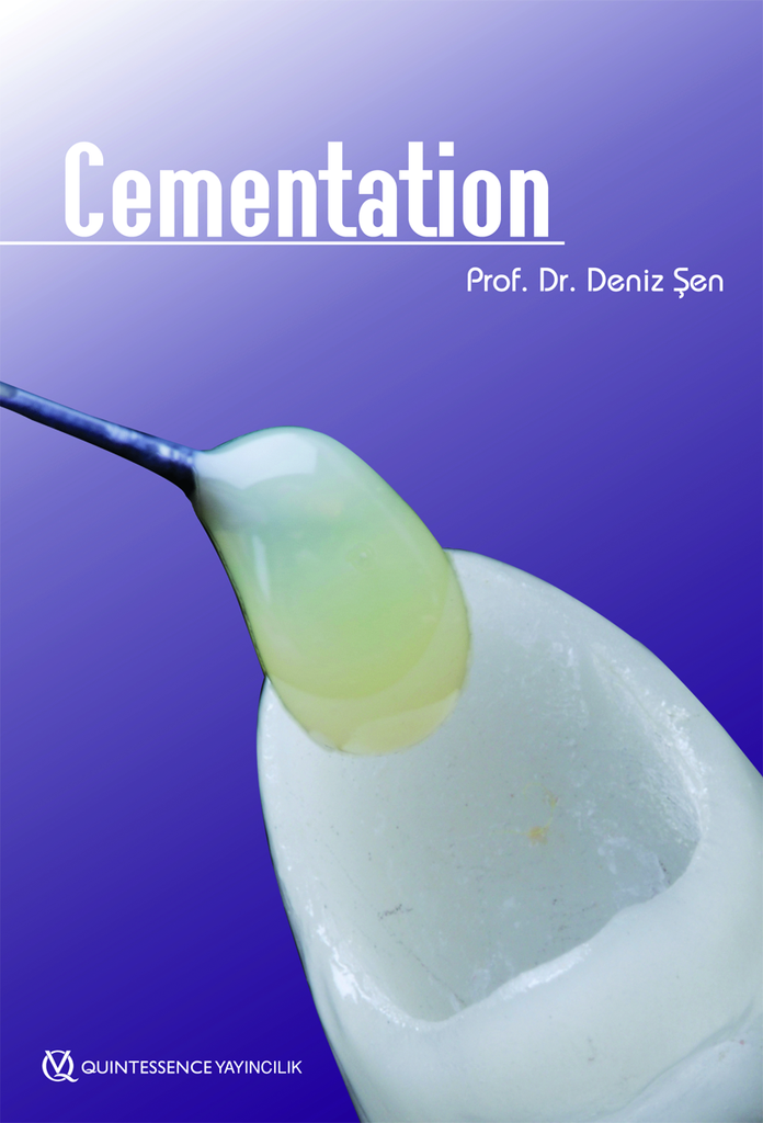 Cementation
