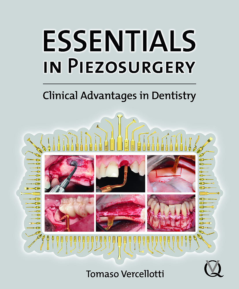 Essentials in Piezosurgery,1st edition 2009