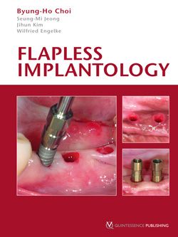 Flapless Implantology