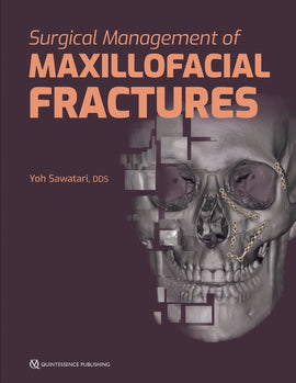 Surgical Management of Maxillofacial Fractures