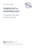 Implantati u estetskoj zoni