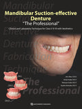 Mandibular Suction-effective Denture "The Professional"