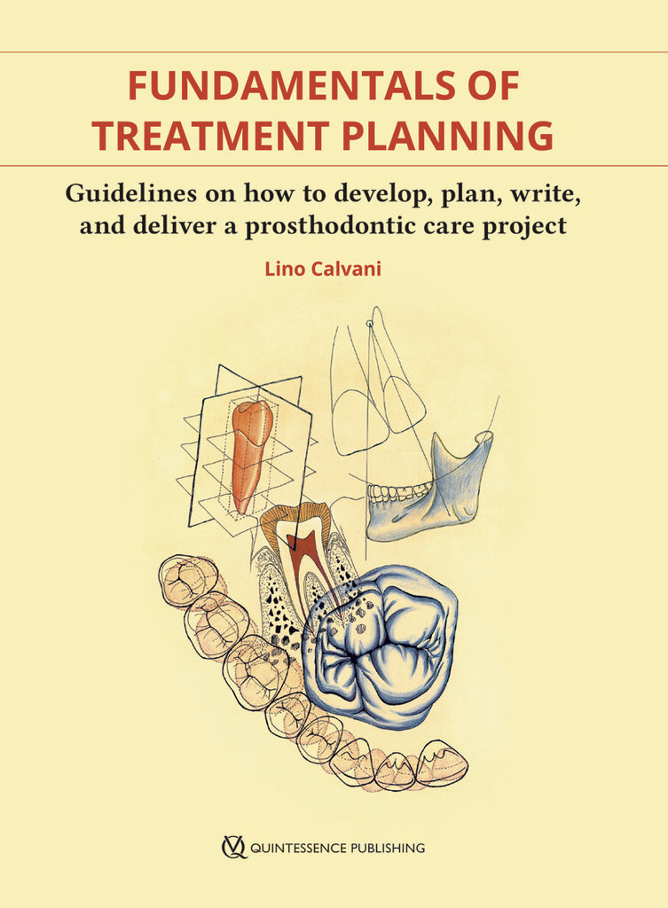 Fundamentals of Treatment Planning