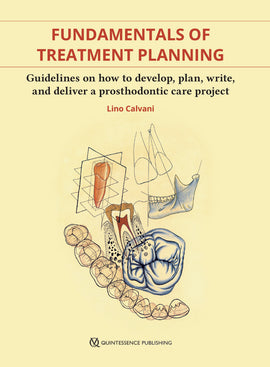 Fundamentals of Treatment Planning