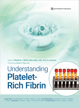 Understanding Platelet‑Rich Fibrin
