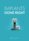 Implants Done Right