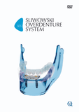 SOS - Sliwowski Overdenture System