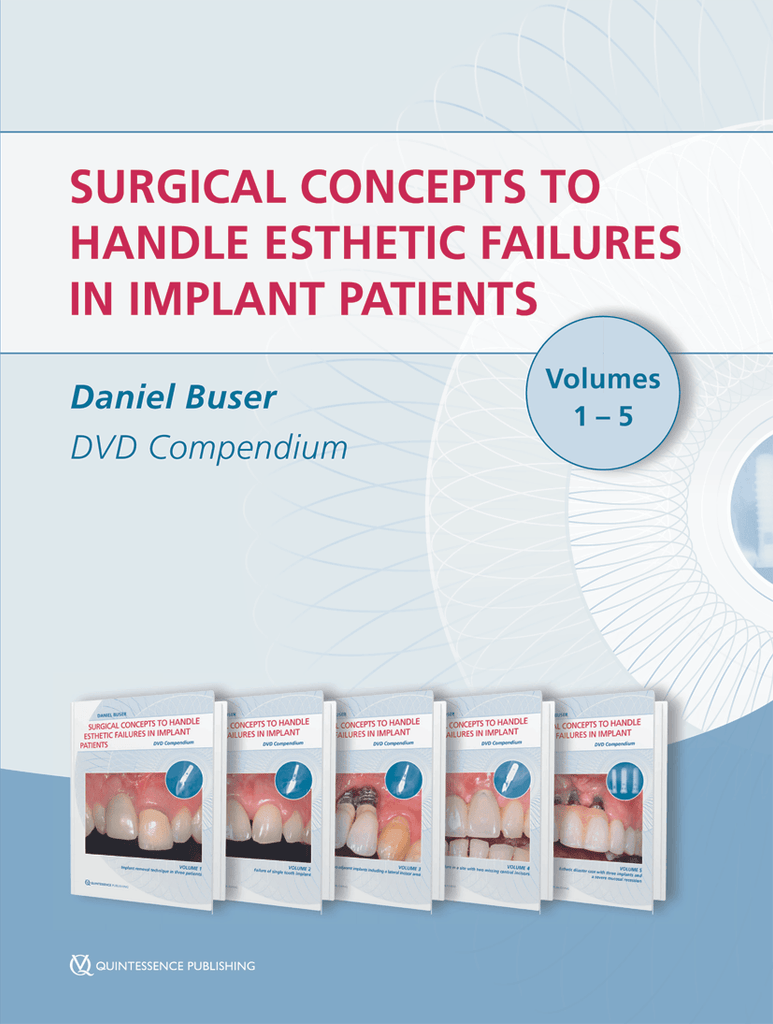 Surgical concepts to handle esthetic failures in implant patients