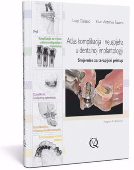 Atlas komplikacija i neuspjeha u dentalnoj implantologiji