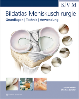 Bildatlas Meniskuschirurgie