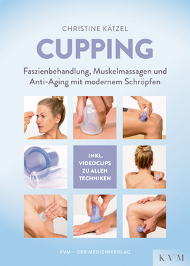 Cupping