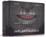 Dentalna implantologija