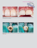 Estetska, parodontna plastična i implantološka kirurgija