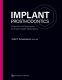 Implant Prosthodontics (Schoenbaum)