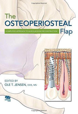 The Osteoperiosteal Flap